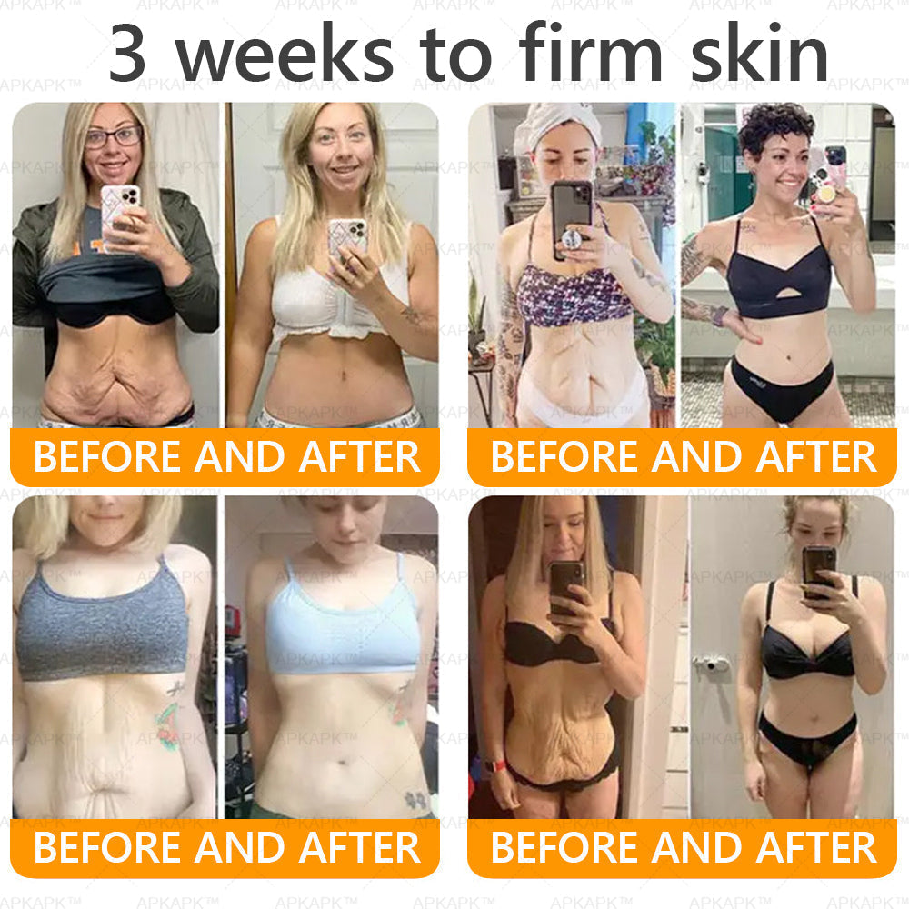 🎀𝗔𝗿𝗶𝗮𝗚𝗹𝗼® 🐝 Bee venom Comprehensive Cream  Sagging Skin, Fine Lines, Loss of Firmness, Flat Bust, Drooping Hips, and More