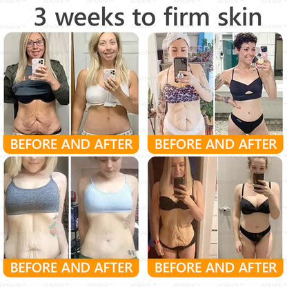 🎀𝗔𝗿𝗶𝗮𝗚𝗹𝗼® 🐝 Bee venom Comprehensive Cream  Sagging Skin, Fine Lines, Loss of Firmness, Flat Bust, Drooping Hips, and More