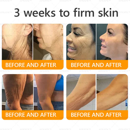 🎀𝗔𝗿𝗶𝗮𝗚𝗹𝗼® 🐝 Bee venom Comprehensive Cream  Sagging Skin, Fine Lines, Loss of Firmness, Flat Bust, Drooping Hips, and More