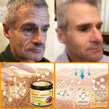 🎀𝗔𝗿𝗶𝗮𝗚𝗹𝗼® 🐝 Bee venom Comprehensive Cream  Sagging Skin, Fine Lines, Loss of Firmness, Flat Bust, Drooping Hips, and More