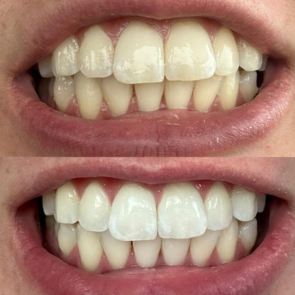 Smileasego™ Whitening Remineralizing Tooth Powder🎁 Fluoride Free🔥Teeth Polish & Stain Remover