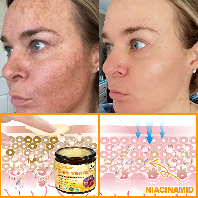 🎀𝗔𝗿𝗶𝗮𝗚𝗹𝗼® 🐝 Bee venom Comprehensive Cream  Sagging Skin, Fine Lines, Loss of Firmness, Flat Bust, Drooping Hips, and More