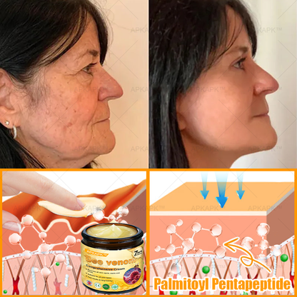🎀𝗔𝗿𝗶𝗮𝗚𝗹𝗼® 🐝 Bee venom Comprehensive Cream  Sagging Skin, Fine Lines, Loss of Firmness, Flat Bust, Drooping Hips, and More