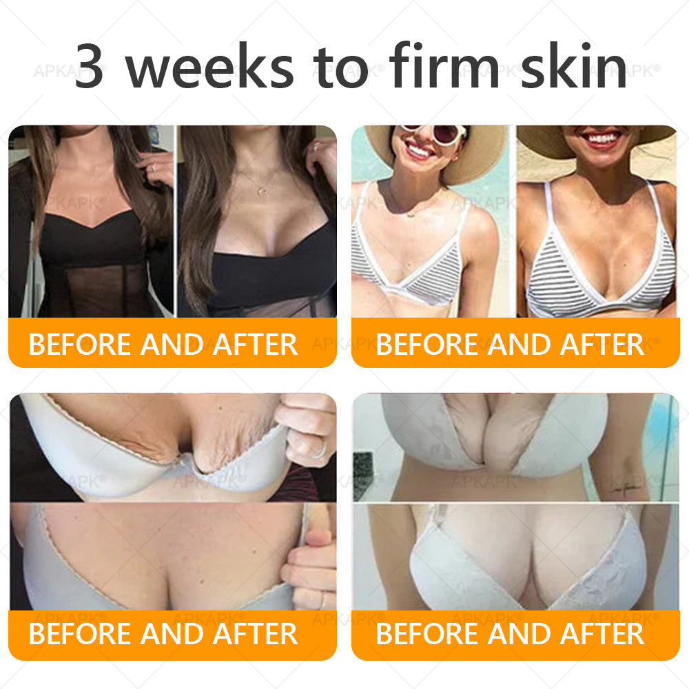 🎀𝗔𝗿𝗶𝗮𝗚𝗹𝗼® 🐝 Bee venom Comprehensive Cream  Sagging Skin, Fine Lines, Loss of Firmness, Flat Bust, Drooping Hips, and More