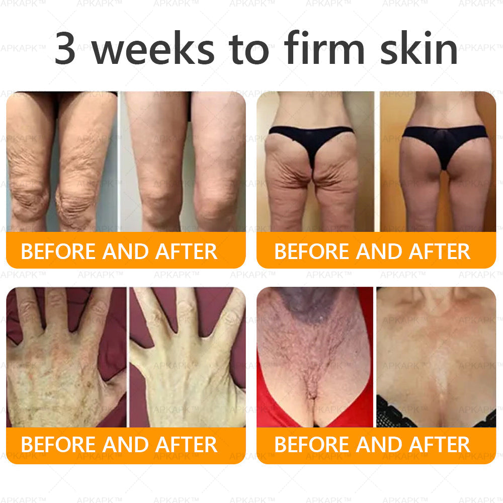 🎀𝗔𝗿𝗶𝗮𝗚𝗹𝗼® 🐝 Bee venom Comprehensive Cream  Sagging Skin, Fine Lines, Loss of Firmness, Flat Bust, Drooping Hips, and More