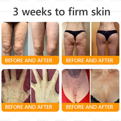 🎀𝗔𝗿𝗶𝗮𝗚𝗹𝗼® 🐝 Bee venom Comprehensive Cream  Sagging Skin, Fine Lines, Loss of Firmness, Flat Bust, Drooping Hips, and More